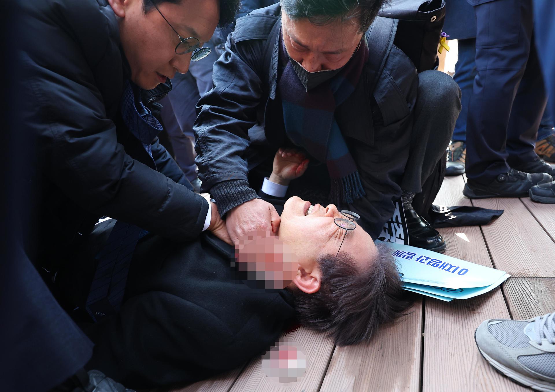 Lee Jae-myung, líder del principal opositor Partido Democrático, se tumba tras ser apuñalado por un agresor en el lado izquierdo del cuello. EFE/EPA/YONHAP