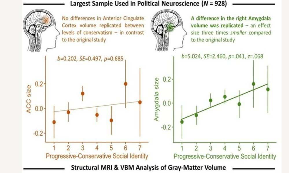 Gráfico del artículo publicado en iScience que analiza la correlación entre la idiología política y la estructura cerebral. Fotografía facilitada por Petropoulos Petalas et al./iScience. EFE