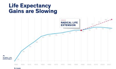 La esperanza de vida aumentó rápidamente durante el siglo XIX y la primera mitad del XX. En 1990, algunos científicos predijeron que esos rápidos avances continuarían, conduciendo a una extensión radical de la vida pero un nuevo análisis sugiere que podríamos estar acercándonos al límite de la longevidad humana. Fotografía facilitada por Marketing Estratégico y Comunicaciones / UIC. EFE