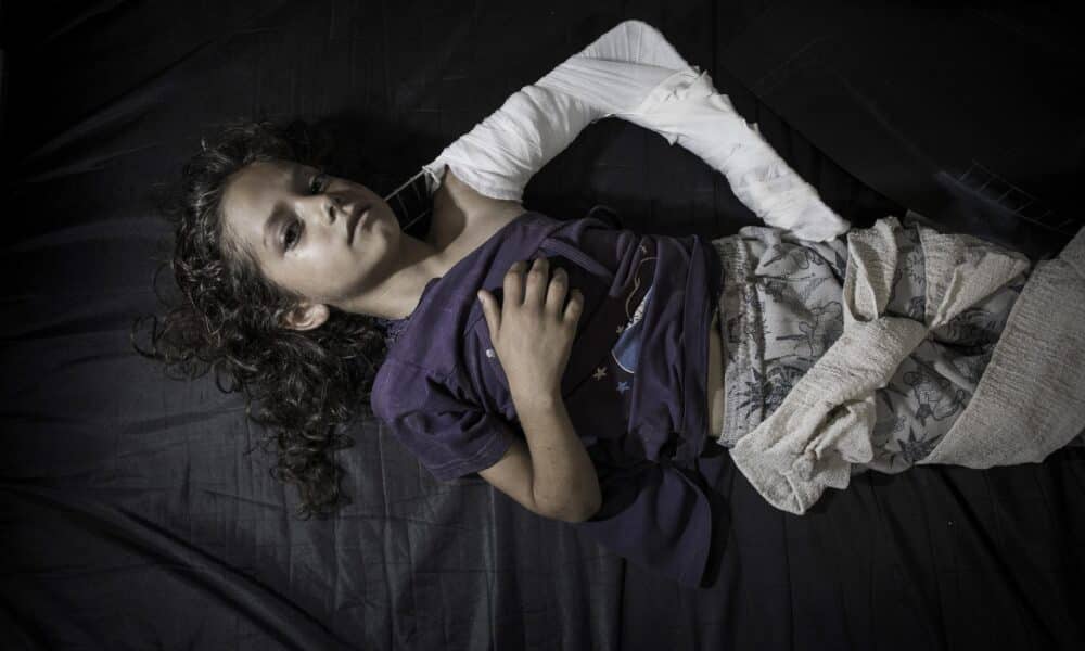 Imagen de archivo de una niña, herida en el bombardeo israelí a la escuela de la localidad de Beit Hanún, en el hospital de Kamal Adwan en Beit Lahiya en Gaza. EFE/Oliver Weiken