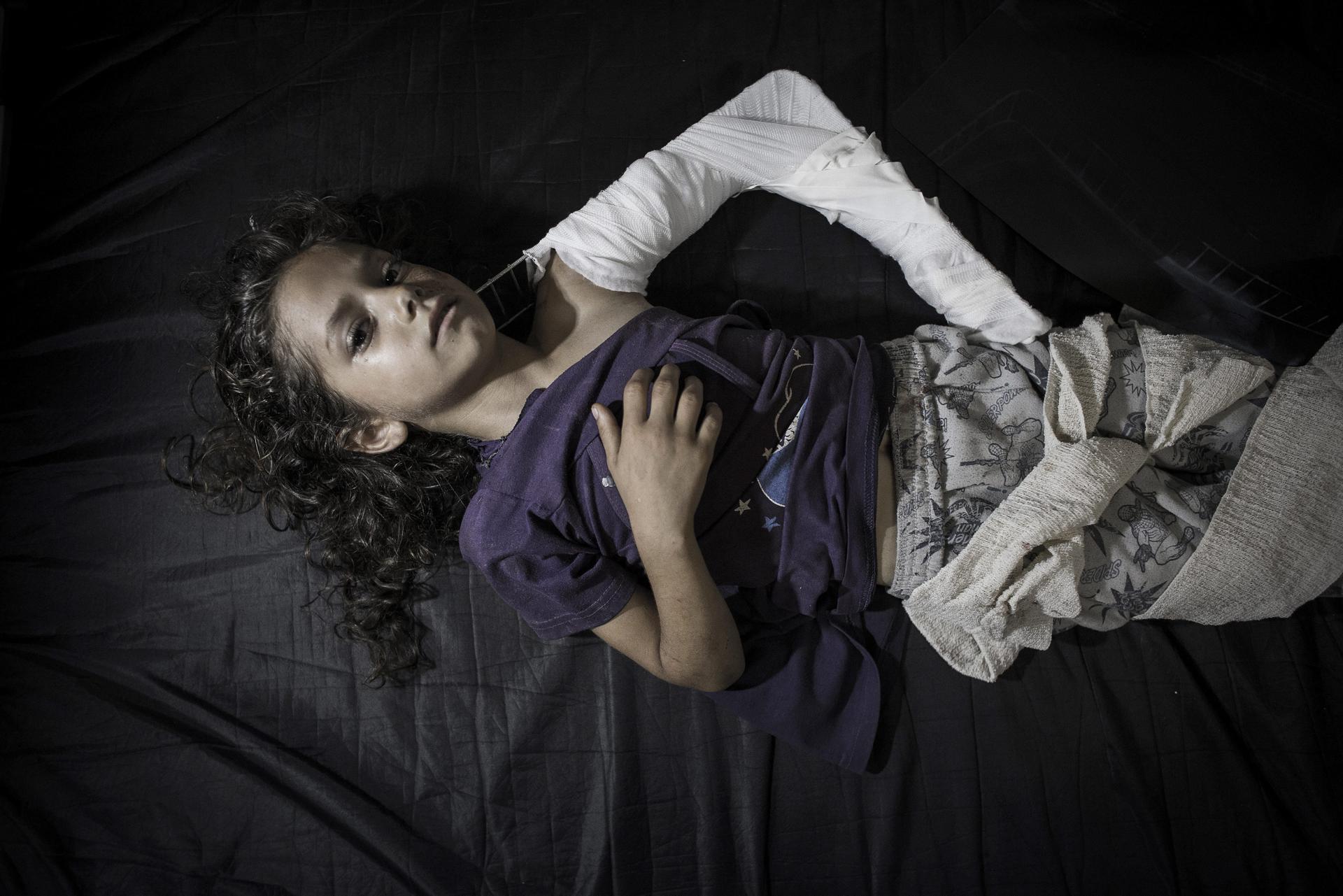 Imagen de archivo de una niña, herida en el bombardeo israelí a la escuela de la localidad de Beit Hanún, en el hospital de Kamal Adwan en Beit Lahiya en Gaza. EFE/Oliver Weiken