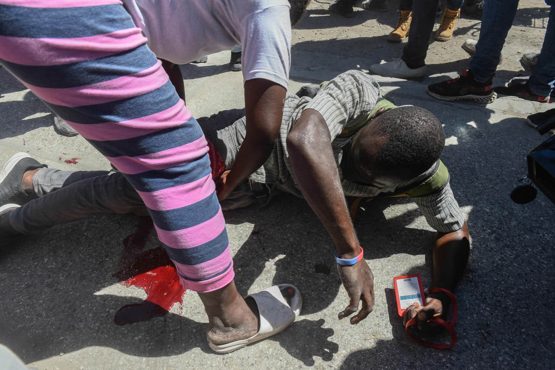 ATENCIÓN EDITORES: CONTENIDO GRÁFICO EXPLÍCITO Fotografía de archivo de un periodista con una herida en la pierna mientras recibe ayuda durante una manifestación, en Puerto Príncipe (Haití). EFE/ Johnson Sabin