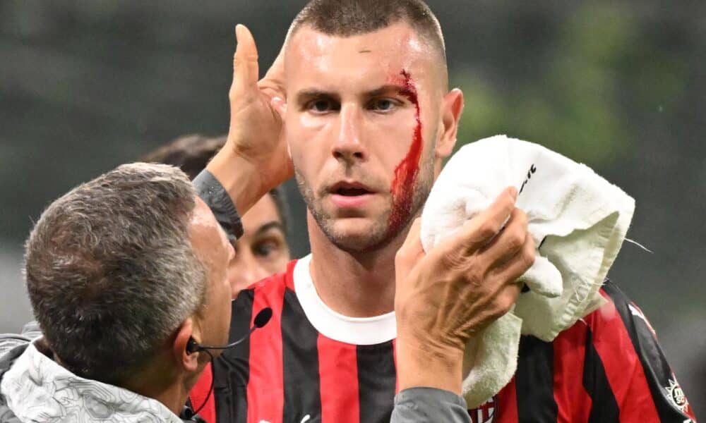 El jugador del AC Milan Strahinja Pavlovic es atendido por el médico durante el partido de la Serie A que han jugado AC Milan y Udinese en el Giuseppe Meazza en Milan, Italia. EFE/EPA/Daniel Dal Zennaro