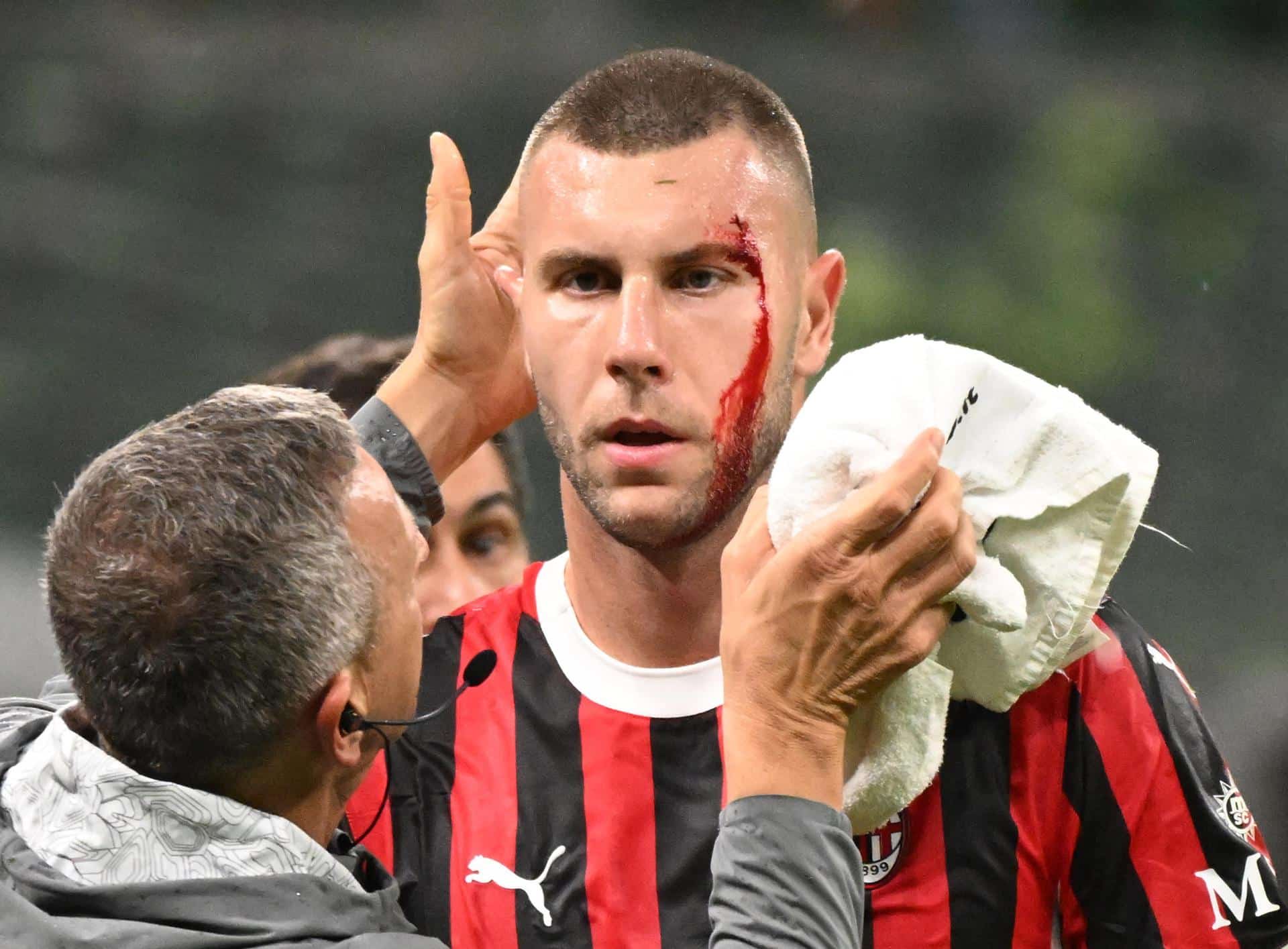 El jugador del AC Milan Strahinja Pavlovic es atendido por el médico durante el partido de la Serie A que han jugado AC Milan y Udinese en el Giuseppe Meazza en Milan, Italia. EFE/EPA/Daniel Dal Zennaro