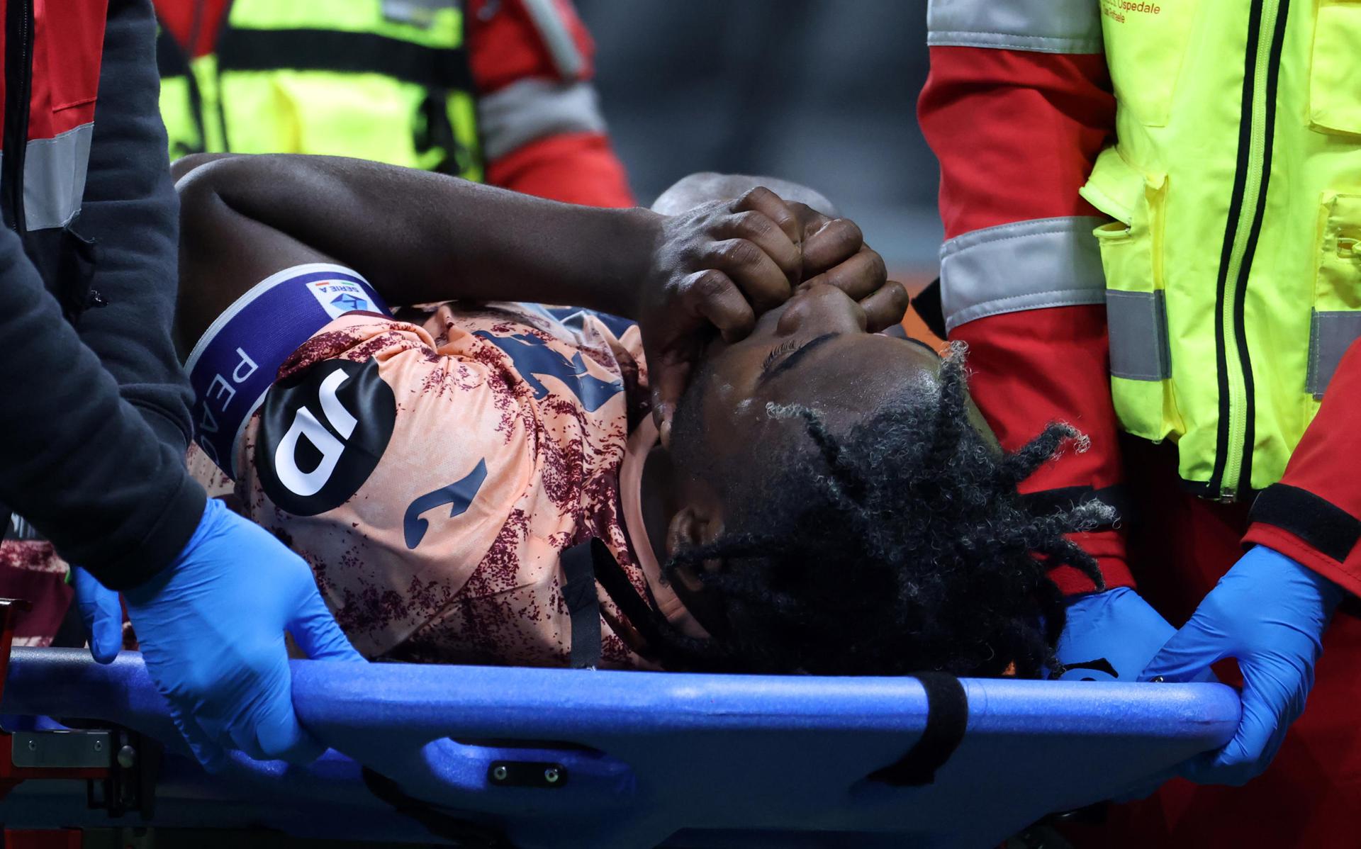 El colombiano Duván Zapata, capitán del Torino, sustituido ante el Inter por una lesión en la rodilla izquierda. EFE/EPA/MATTEO BAZZI