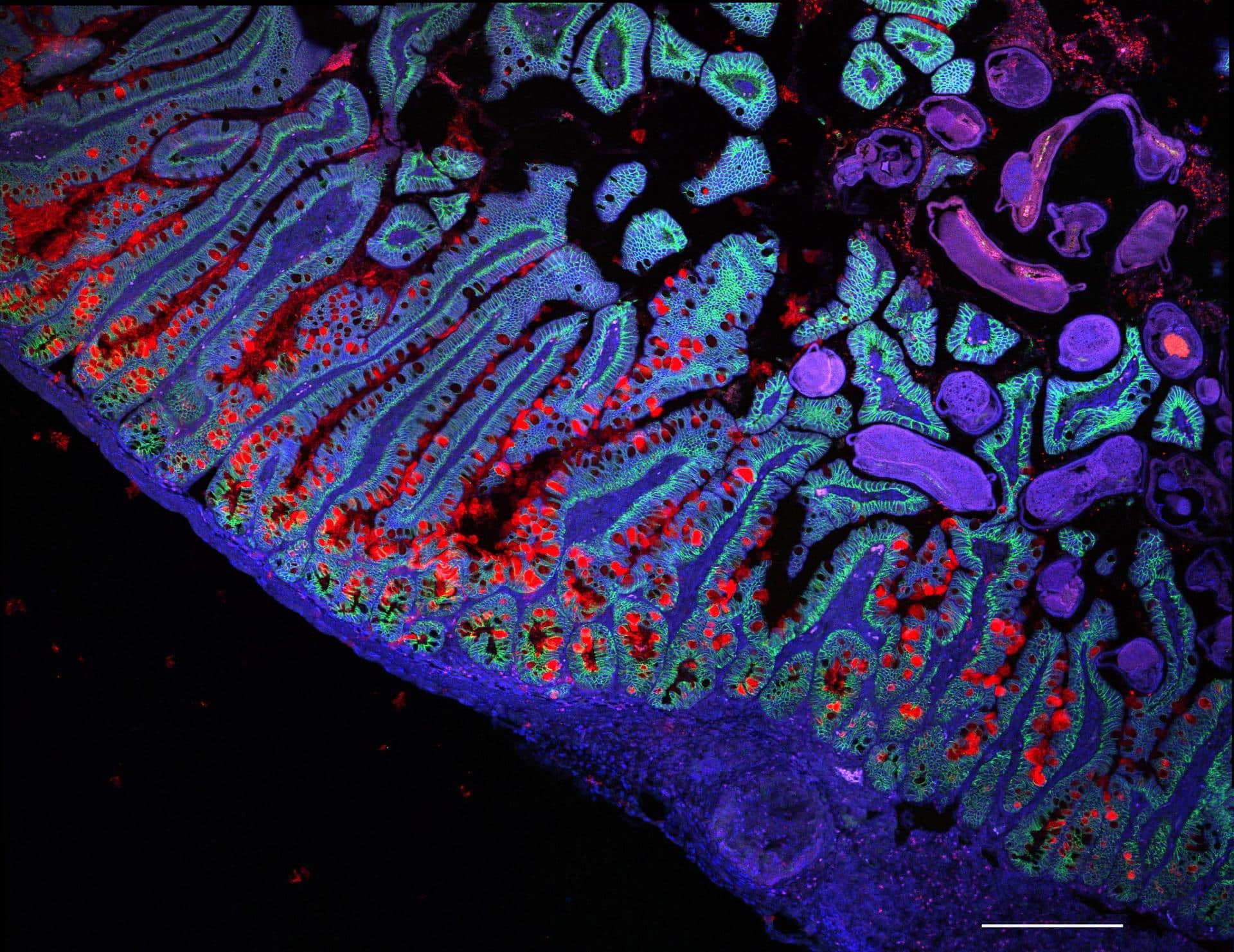 Imagen que muestra el intestino delgado humano. Crédito: Grace Burgin, Noga Rogel y Moshe Biton, Observatorio Klarman de Células, Instituto Broad.