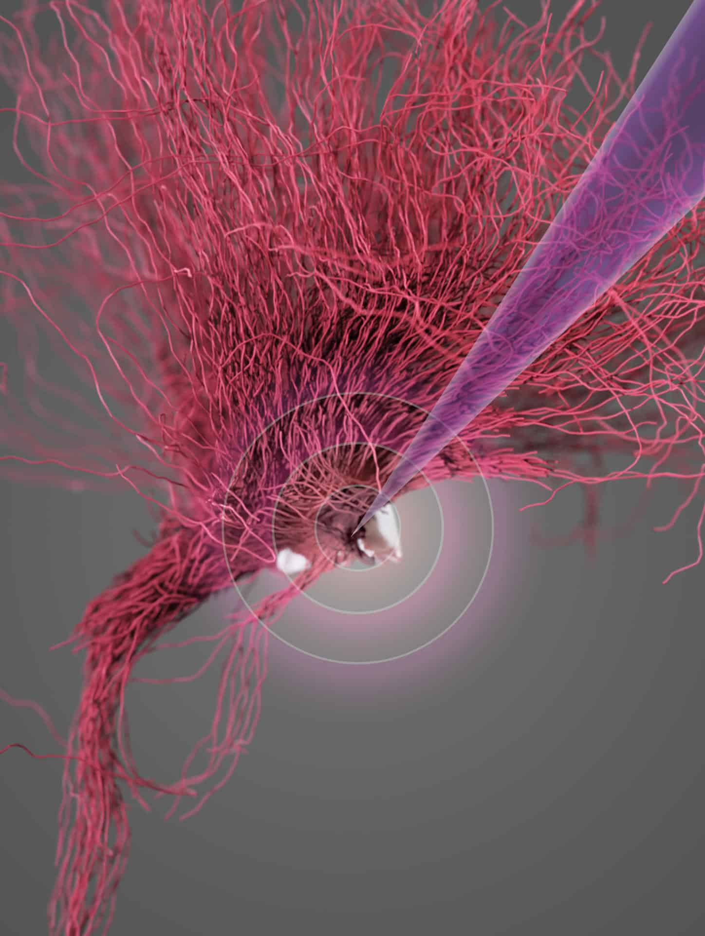 Representación visual de la estimulación cerebral profunda del hipotálamo lateral.Crédito: NeuroRestore/EPFL 2024.