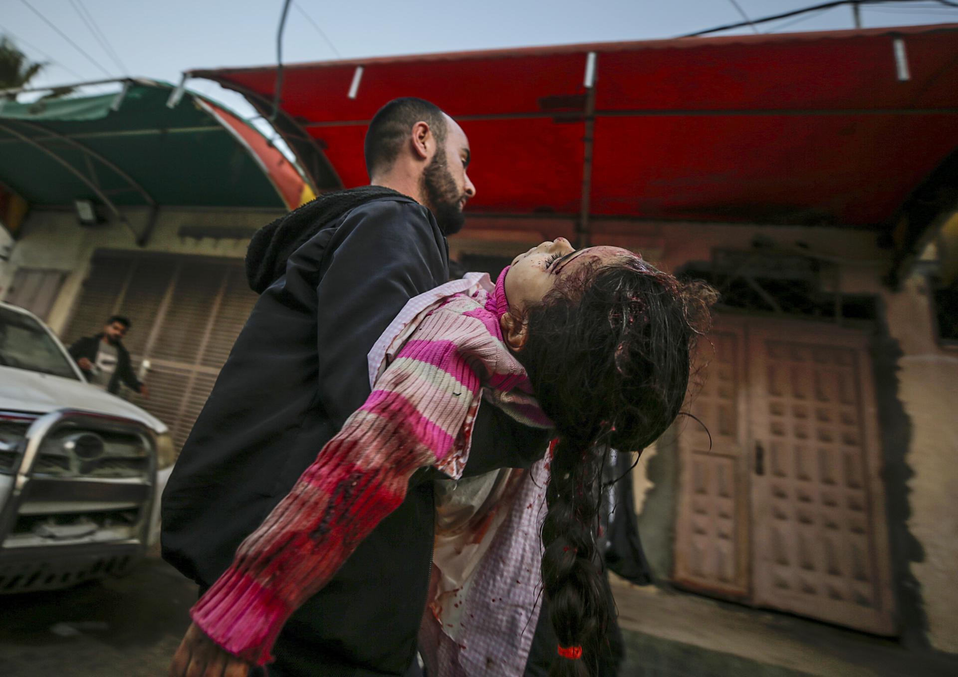 Un palestino traslada el cuerpo de un niña herida a un hospital de Deir Al Balah, en el centro de Gaza. EFE/EPA/MOHAMMED SABER