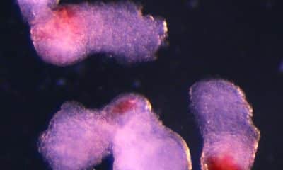 El equipo observó la aparición de estructuras tridimensionales similares a embriones bajo un microscopio en el laboratorio. Estas comenzaron a producir sangre (que se ve aquí en rojo) después de aproximadamente dos semanas de desarrollo, imitando el proceso de desarrollo en embriones humanos. Crédito: Jitesh Neupane, Universidad de Cambridge.