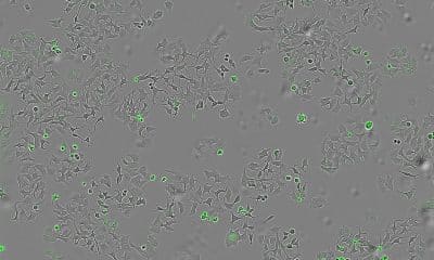 Un estudio internacional liderado por el Centro de Investigación del Cáncer (CIC) ha identificado un mecanismo por el cual una proteína secretada por la bacteria 'vibrio cholerae' es capaz de destruir células cancerosas. La imagen representa las células de cáncer muertas al activarse esa proteína. Imagen cedida por el CIC.