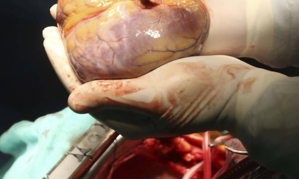 Transplante de un corazón en un quirófano del Hospital Reina Sofía de Córdoba, EFE/Archivo/Salas