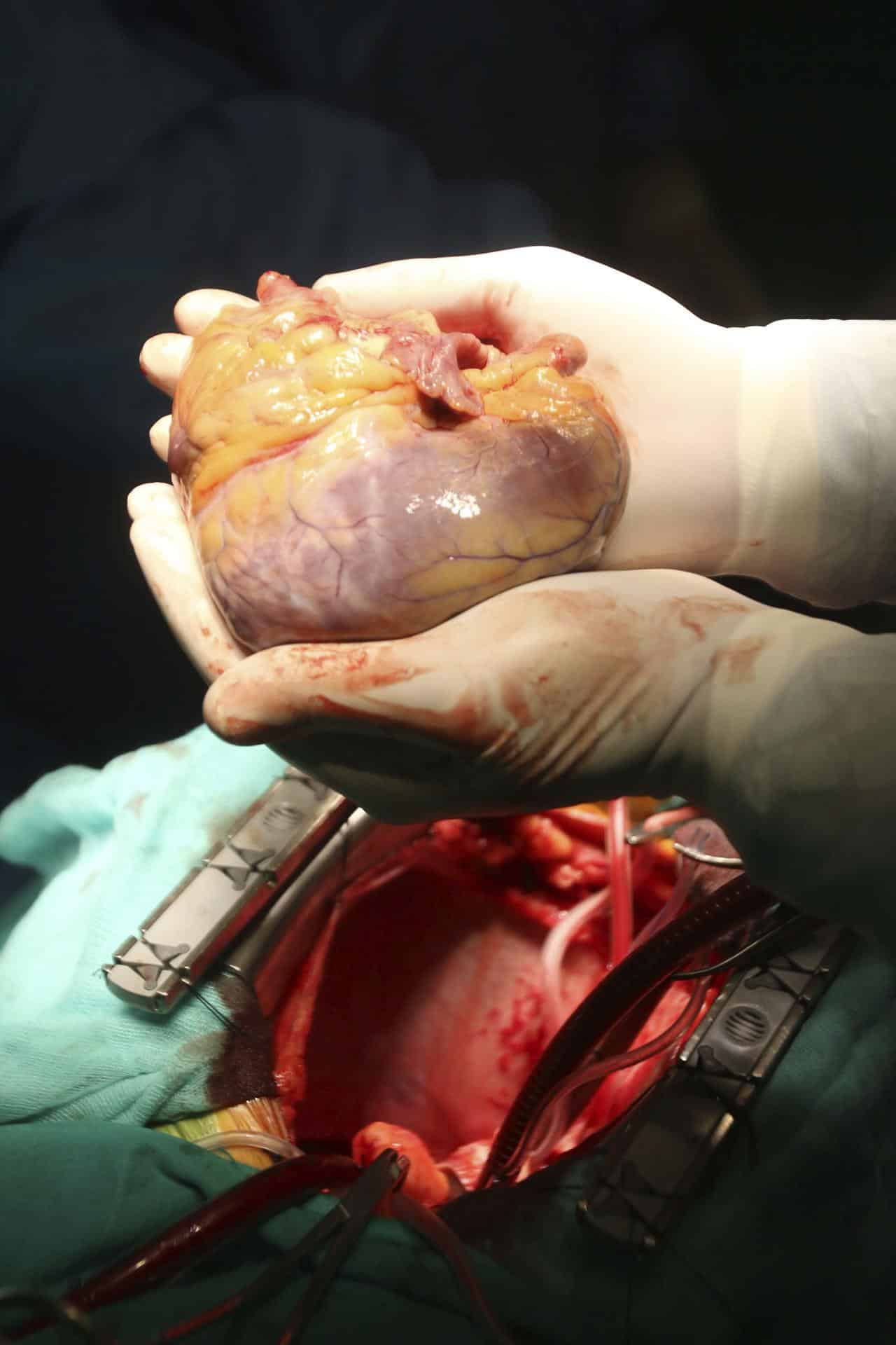 Transplante de un corazón en un quirófano del Hospital Reina Sofía de Córdoba, EFE/Archivo/Salas