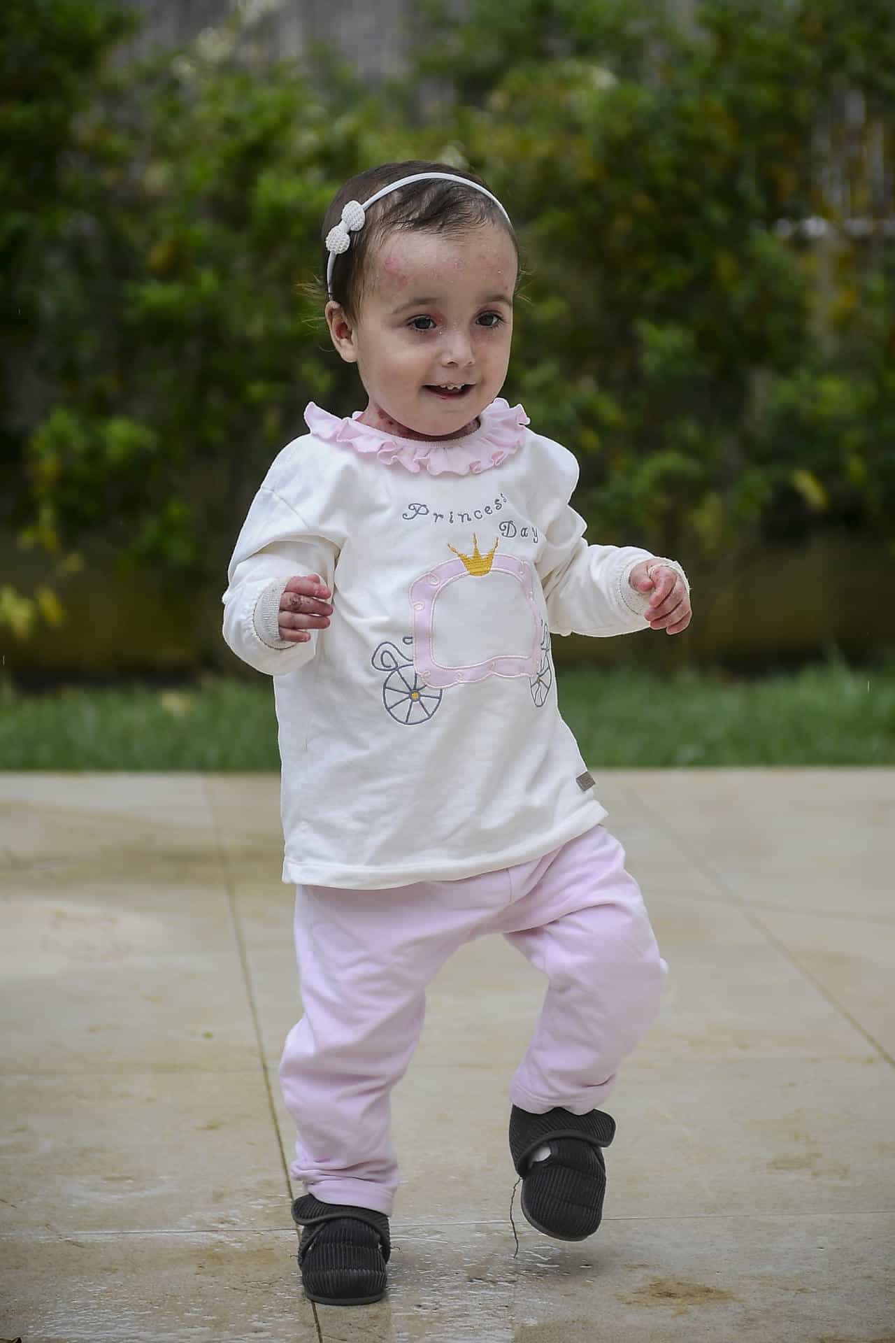 Olivia es una niña mallorquina de 2 años que tiene "piel de mariposa". EFE/Archivo/ MIQUEL A. BORRÀS