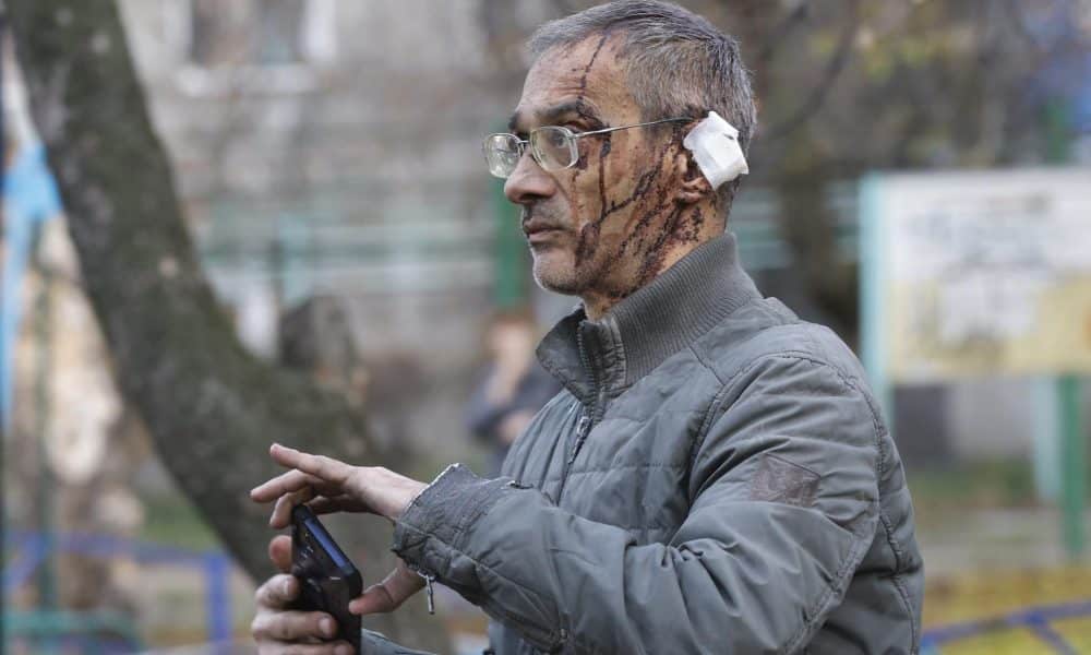 Un herido en el ataque ruso sobre Kiev. EFE/EPA/SERGEY DOLZHENKO