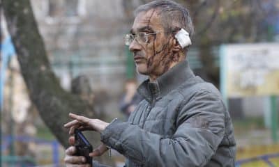 Un herido en el ataque ruso sobre Kiev. EFE/EPA/SERGEY DOLZHENKO