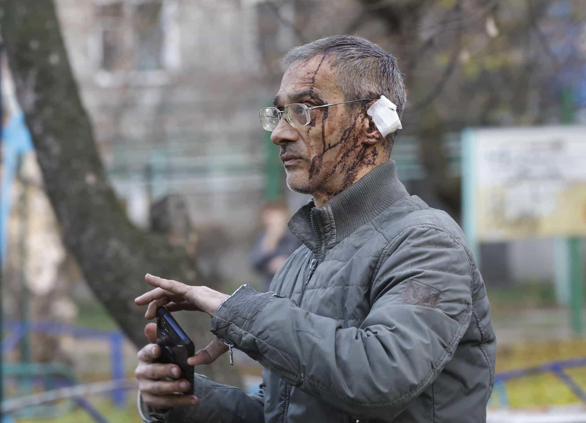 Un herido en el ataque ruso sobre Kiev. EFE/EPA/SERGEY DOLZHENKO