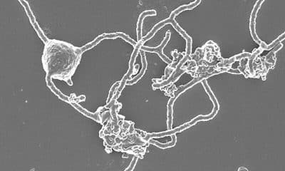 Imagen microscópica sin fecha específica cedida este jueves, 13 de noviembre, por la "expedición buscando a nuestros ancestros microbianos" que muestra ejemplares de microbios arqueas de Asgard. EFE/Expedición buscando a nuestros ancestros microbianos