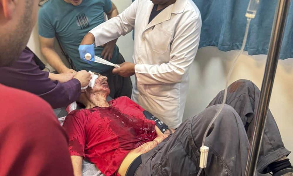 Al menos once personas resultaron heridas, entre ellas paramédicos y periodistas, durante un ataque de colonos israelíes en la aldea palestina de Beita, cerca de Nablus (norte de Cisjordania), según informaron a EFE testigos de la agresión y reportaron la Media Luna Roja y Sanidad palestinas. En la imagen aparece en una camilla el periodista de la cadena catarí Al Jazeera Mohammed Al Atrash, mientras es atendido en el Hospital Gubernamental de Rafidia. EFE/Cedida por un testigo -SOLO USO EDITORIAL/SOLO DISPONIBLE PARA ILUSTRAR LA NOTICIA QUE ACOMPAÑA (CRÉDITO OBLIGATORIO)-