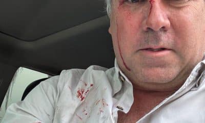 Fotografía tomada de la cuenta oficial @CostaGino de la red social X del excongresista de Perú, Gino Costa, donde se observa al candidato a la Presidencia de Perú Rafael Belaúnde Llosa, después de sufrir un atentado en su contra este martes, en Lima (Perú). EFE/@costagino