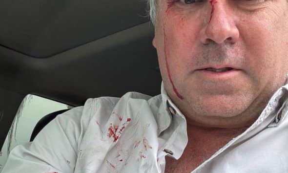 Fotografía tomada de la cuenta oficial @CostaGino de la red social X del excongresista de Perú, Gino Costa, donde se observa al candidato a la Presidencia de Perú Rafael Belaúnde Llosa, después de sufrir un atentado en su contra este martes, en Lima (Perú). EFE/@costagino