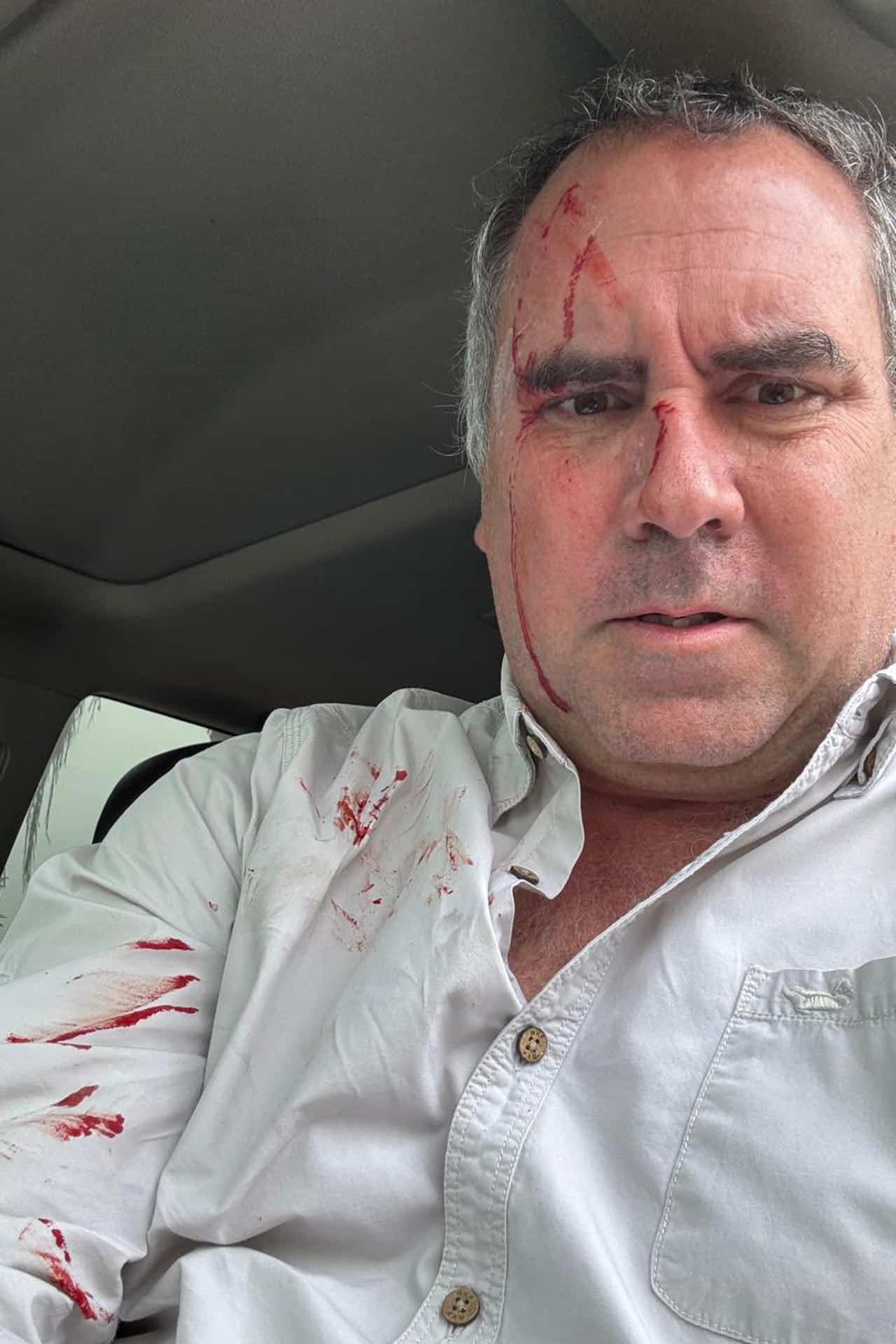 Fotografía tomada de la cuenta oficial @CostaGino de la red social X del excongresista de Perú, Gino Costa, donde se observa al candidato a la Presidencia de Perú Rafael Belaúnde Llosa, después de sufrir un atentado en su contra este martes, en Lima (Perú). EFE/@costagino