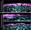 Vista lateral que muestra la similitud del nuevo modelo endometrial (dos imágenes inferiores) con una biopsia de tejido endometrial (imagen superior). Se observan dos tipos de células: la capa epitelial externa (de color rosa) y la capa estromal interna (de color azul). Crédito Max Polanek, de la Universidad de Stanford.

