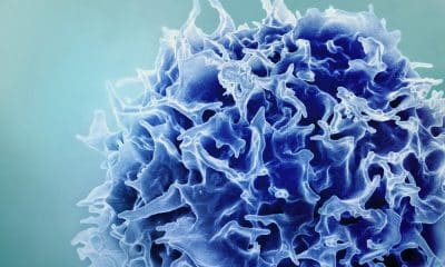 Investigadores descubrieron una manera de activar el hígado para contrarrestar el declive de las células T (en la imagen), restaurando su número y potenciando la respuesta del organismo a la vacunación. Para ello emplearon tecnología ARNm, usada en algunas de las vacunas covid. Crédito: NIAID/MIT. Bajo licencia Creative Commons Atribución-No Comercial. Sin Obras Derivadas