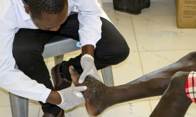 LODWAR, 02/12/2025.- El micetoma es una enfermedad tropical desatendida que, frente a la falta de investigación y fondos, devasta la vida de un número desconocido de habitantes del condado más pobre de Kenia, Turkana. El micetoma integra la lista de 25 enfermedades que afectan a millones de personas, a menudo marginadas, sobre todo en zonas tropicales del planeta, y para las que los tratamientos son anticuados, tóxicos, inexistentes o difíciles y caros.-EFE/ Lucía Blanco