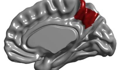 El precúneo se sitúa en la hendidura entre los dos hemisferios cerebrales. En la imagen, esta región resaltada en rojo sobre la cara interna de uno de los hemisferios. Imagen: Emiliano Bruner/Consejo Superior de Investigaciones Científicas