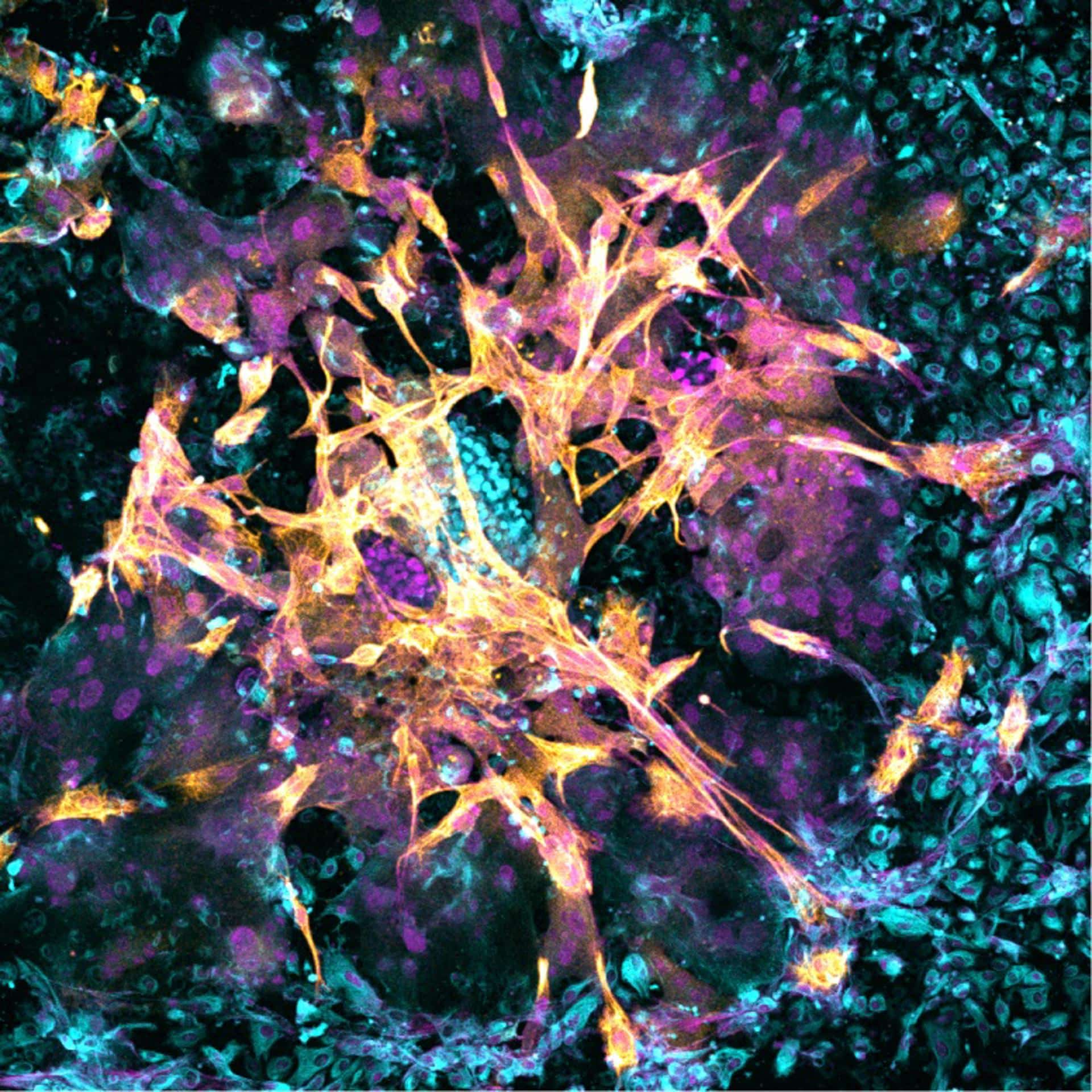 Imagen microscópica de un embrión humano de 14 días que se ha implantado en el nuevo modelo endometrial. Las células de color azul brillante en el centro de la imagen son células epiblasto no especializadas que, más adelante en el desarrollo, formarán todos los tejidos del cuerpo. Las células de color naranja son células trofoblasto que más adelante formarán la placenta. Las células azules que rodean al embrión son células endometriales que favorecen la implantación y el crecimiento del embrión. Crédito Matteo Molè, del Instituto Babraham.