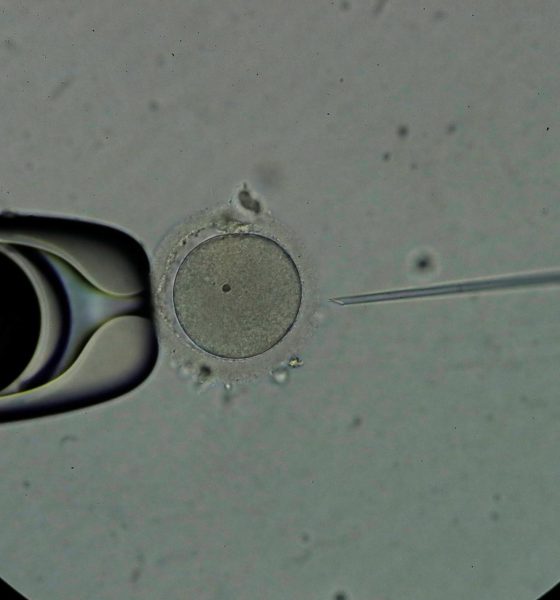 Personal técnico trabaja con espermatozoides en una clínica de reproducción asistida, en una imagen de archivo. EFE/Bienvenido Velasco