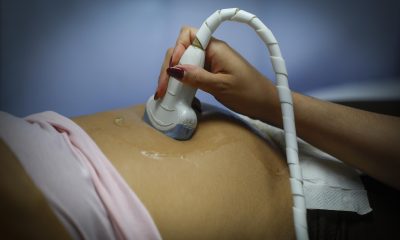 Una mujer embarazada se realiza un ultrasonido en una imagen de archivo. EFE/ Francisco Guasco