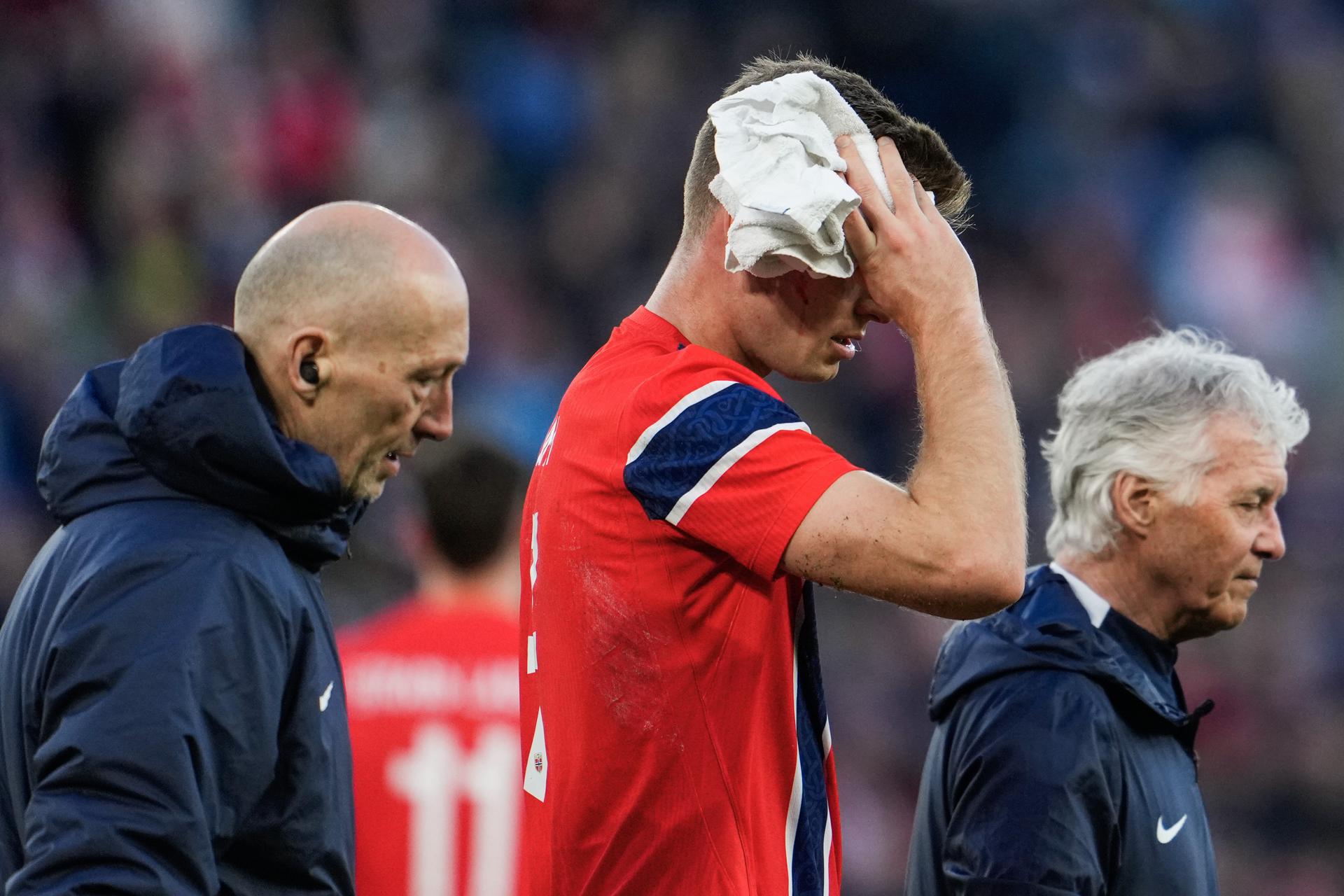 El internacional noruego Alexander Sorloth abandona el terreno de juego con un golpe en la cabeza durante el partido que enfrentó este martes a su selección con la de Suiza. EFE/ FREDRIK VARFJELL *Prohibido Noruega*