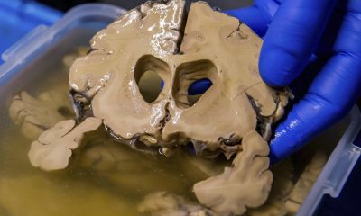 Fotografía de archivo donde se observa un cerebro tras una disección. EFE/Stephanie Lecocq