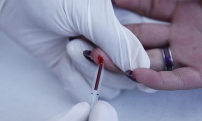 Una persona se realiza una prueba de Hepatitis en Ciudad de México (México). Fotografía de archivo. EFE/Sáshenka Gutiérrez